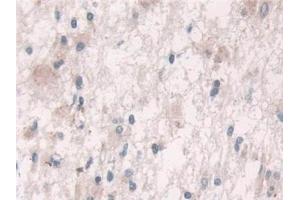Immunohistochemistry (IHC) image for anti-Growth Factor Receptor-Bound Protein 10 (GRB10) (AA 392-594) antibody (ABIN7436048)