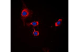 Immunofluorescent analysis of GABRB1 (pS434) staining in MCF7 cells. (GABRB1 抗体  (C-Term, pSer434))