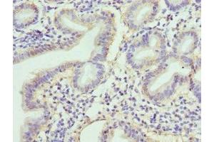 Immunohistochemistry of paraffin-embedded human duodenal tissue using ABIN7167845 at dilution of 1:100 (RBP2 抗体  (AA 1-134))