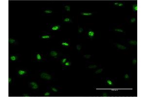 Immunofluorescence of monoclonal antibody to MEFV on HeLa cell. (MEFV 抗体  (AA 1-110))