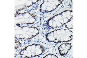 Immunohistochemistry (IHC) image for anti-SATB Homeobox 2 (SATB2) antibody (ABIN7270152)