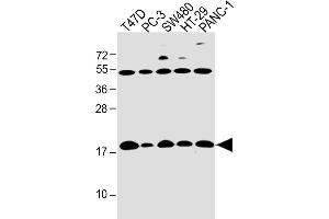 All lanes : Anti-IFITM5 Antibody (Center) at 1:4000 dilution Lane 1: T47D whole cell lysate Lane 2: PC-3 whole cell lysate Lane 3: S whole cell lysate Lane 4: HT-29 whole cell lysate Lane 5: NC-1 whole cell lysate Lysates/proteins at 20 μg per lane.
