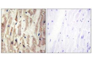Immunohistochemistry (IHC) image for anti-Laminin, alpha 4 (LAMa4) (Internal Region) antibody (ABIN1850448) (LAMa4 抗体  (Internal Region))