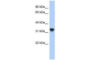 CENPP antibody used at 1 ug/ml to detect target protein. (CENPP 抗体  (N-Term))