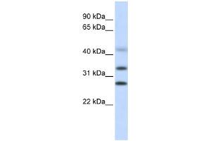 WB Suggested Anti-CENPH Antibody Titration: 0.