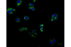 Immunofluorescent analysis of HepG2 cells using ABIN7143307 at dilution of 1:100 and Alexa Fluor 488-congugated AffiniPure Goat Anti-Rabbit IgG(H+L) (Adenosine A2b Receptor 抗体  (AA 292-332))