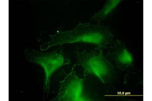 Immunofluorescence of monoclonal antibody to DNAJA4 on HeLa cell. (DNAJA4 抗体  (AA 1-397))