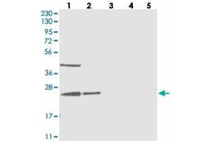 Western blot analysis of Lane 1: RT-4, Lane 2: U-251 MG, Lane 3: Human Plasma, Lane 4: Liver, Lane 5: Tonsil with UQCC polyclonal antibody  at 1:250-1:500 dilution. (Ubiquinol-Cytochrome C Reductase Complex Chaperone (UQCC) 抗体)