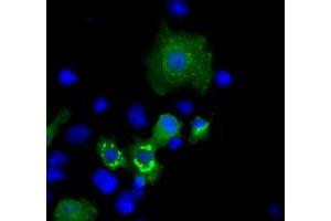 Image no. 1 for anti-Induced Myeloid Leukemia Cell Differentiation Protein Mcl-1 (MCL1) antibody (ABIN1499341) (MCL-1 抗体)