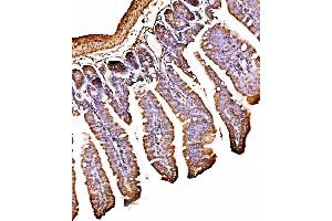 IHC analysis of ORP150/HYOU1 using anti-ORP150/HYOU1 antibody (ABIN7601807). (HYOU1 抗体  (AA 46-913))