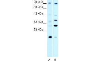 WB Suggested Anti-PAntibody Titration:  0. (PARP11 抗体  (N-Term))
