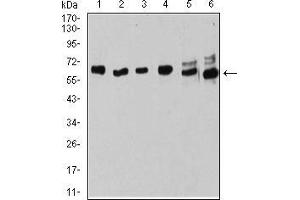 Western blot analysis using ESR1 mouse mAb against MOLT4 (1), Raji (2), MCF-7 (3), T47D (4), SK-Br-3 (5), and Hela (6) cell lysate. (Estrogen Receptor alpha 抗体  (AA 2-185))