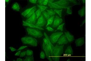 Immunofluorescence of monoclonal antibody to TUBA1 on HeLa cell. (TUBA4A 抗体  (AA 1-448))