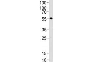 Western blot analysis of mouse thymus tissue lysate using Lck antibody at 1:1000.