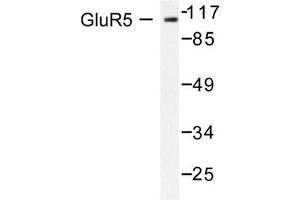 Image no. 1 for anti-Glutamate Receptor, Ionotropic, Kainate 1 (GRIK1) antibody (ABIN265438) (GRIK1 抗体)