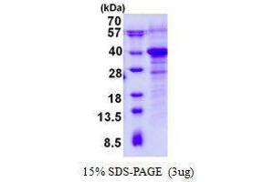 Figure annotation denotes ug of protein loaded and % gel used. (RWDD1 蛋白)