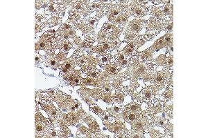 Immunohistochemistry of paraffin-embedded rat liver using ERK5 Rabbit pAb (ABIN3022944, ABIN3022945, ABIN3022946 and ABIN6219309) at dilution of 1:50 (40x lens). (MAPK7 抗体  (AA 1-310))