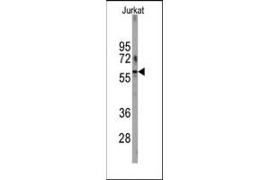 Image no. 1 for anti-6-phosphofructo-2-Kinase/fructose-2,6-Biphosphatase 1 (PFKFB1) (N-Term) antibody (ABIN360656) (PFKFB1 抗体  (N-Term))
