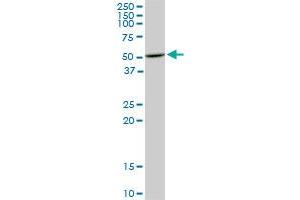 HDAC3 monoclonal antibody (M02), clone 3E11. (HDAC3 抗体  (AA 319-428))
