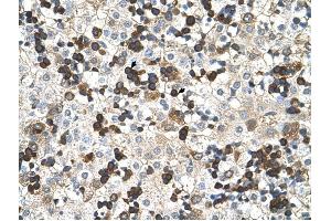 Hemoglobin Zeta antibody was used for immunohistochemistry at a concentration of 4-8 ug/ml to stain Hemopoietic cells (arrows) in Human Liver. (HBZ 抗体  (N-Term))