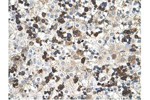 Hemoglobin Zeta antibody was used for immunohistochemistry at a concentration of 4-8 ug/ml to stain Hemopoietic cells (arrows) in Human Liver.