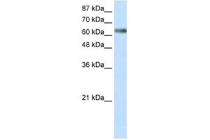 WB Suggested Anti-ZNF447 Antibody Titration: 0.