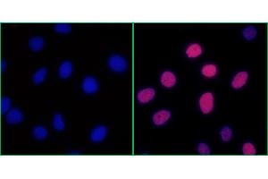 Immunofluorescence (IF) image for anti-Replication Protein A2, 32kDa (RPA2) (pSer4), (pSer8) antibody (ABIN7453379) (Recombinant RPA2 抗体  (pSer4, pSer8))