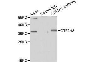 Immunoprecipitation analysis of 200 μg extracts of HT-29 cells using 1 μg GTF2H3 antibody (ABIN5974322). (GTF2H3 抗体)
