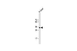 Anti-GNMT Antibody (Center) at 1:1000 dilution + human liver lysate Lysates/proteins at 20 μg per lane. (GNMT 抗体  (AA 78-106))