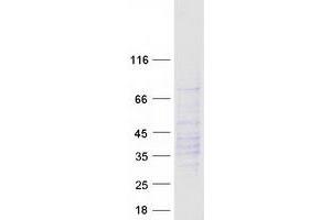 Western Blotting (WB) image for Chemokine (C-X-C Motif) Receptor 2 (CXCR2) protein (Myc-DYKDDDDK Tag) (ABIN2713477)