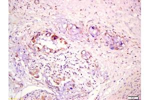 Immunohistochemistry (IHC) image for anti-Sodium Channel, Nonvoltage-Gated 1, beta (SCNN1B) (AA 401-500) antibody (ABIN705911)