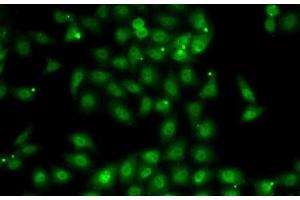 Immunofluorescence analysis of MCF7 cells using MBNL1 Polyclonal Antibody (MBNL1 抗体)