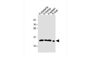 All lanes : Anti- HBE1 Antibody (Center) at 1:1000 dilution Lane 1: human placenta lysate Lane 2: human kidney lysate Lane 3: human spleen lysate Lane 4: human liver lysate Lysates/proteins at 20 μg per lane. (Hemoglobin, epsilon 1 (HBe1) (AA 55-83) 抗体)