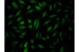 Immunofluorescence staining of Hela Cells with ABIN7127543 at 1:50, counter-stained with DAPI. (Recombinant EPAS1 抗体)