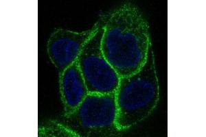 Immunofluorescent analysis of A431 cells, using EGFR Antibody . (Recombinant EGFR 抗体)