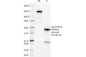 SDS-PAGE Analysis Purified PLAP Mouse Monoclonal Antibody (GM022). (PLAP 抗体)