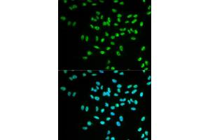 Immunofluorescence analysis of MCF-7 cells using FANCD2 antibody. (FANCD2 抗体)