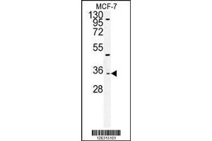 Western blot analysis of TTPAL Antibody in MCF-7cell line lysates (35ug/lane) (TTPAL 抗体  (C-Term))