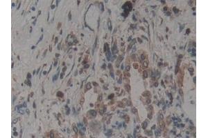 Immunohistochemistry (IHC) image for anti-Calnexin (CANX) (AA 239-461) antibody (ABIN7431509)