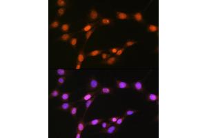 Immunofluorescence (IF) image for anti-Histone Deacetylase 8 (HDAC8) antibody (ABIN7267714)