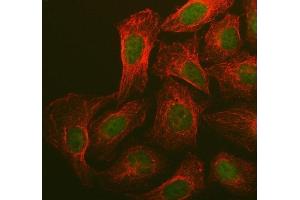 anti-Breast Cancer 1 (BRCA1) (AA 1681-1781) antibody