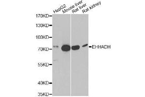 Western blot analysis of extracts of various cell lines, using EHHADH antibody. (EHHADH 抗体  (AA 444-723))