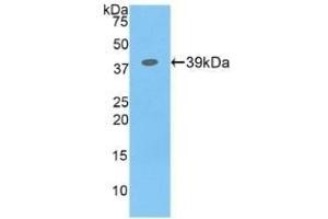 Detection of Recombinant CSF2Rb, Human using Polyclonal Antibody to Colony Stimulating Factor 2 Receptor Beta (CSF2Rb) (CD131 抗体  (AA 133-233))