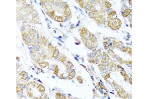 Immunohistochemistry of paraffin-embedded Human stomach using DARS2 Polyclonal Antibody at dilution of 1:100 (40x lens). (DARS2 抗体)