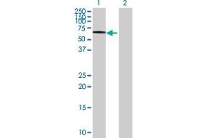 Western Blot analysis of SCARB2 expression in transfected 293T cell line by SCARB2 MaxPab polyclonal antibody. (SCARB2 抗体  (AA 1-478))