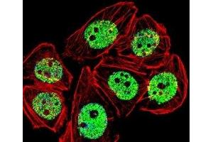 Fluorescent confocal image of A549 cells stained with FOXG1 antibody. (FOXG1 抗体  (AA 225-252))