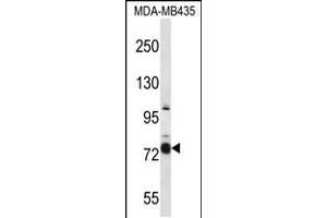 Western blot analysis in MDA-MB435 cell line lysates (35ug/lane). (CASS4 抗体  (C-Term))