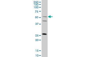 FLJ36180 monoclonal antibody (M01), clone 4F8 Western Blot analysis of FLJ36180 expression in A-431 . (TRIML1 抗体  (AA 369-468))