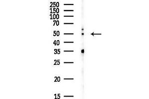 anti-Prune Exopolyphosphatase (PRUNE) antibody