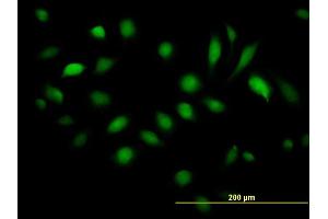 Immunofluorescence of purified MaxPab antibody to BAG5 on HeLa cell. (BAG5 抗体  (AA 1-447))